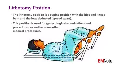 截刀臥位|截石位 lithotomy position